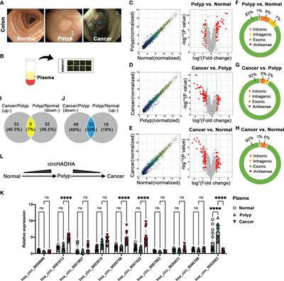 CircHADHA-augmented autophagy suppresses tumor growth of colon cancer by regulating autophagy-related gene via miR-361